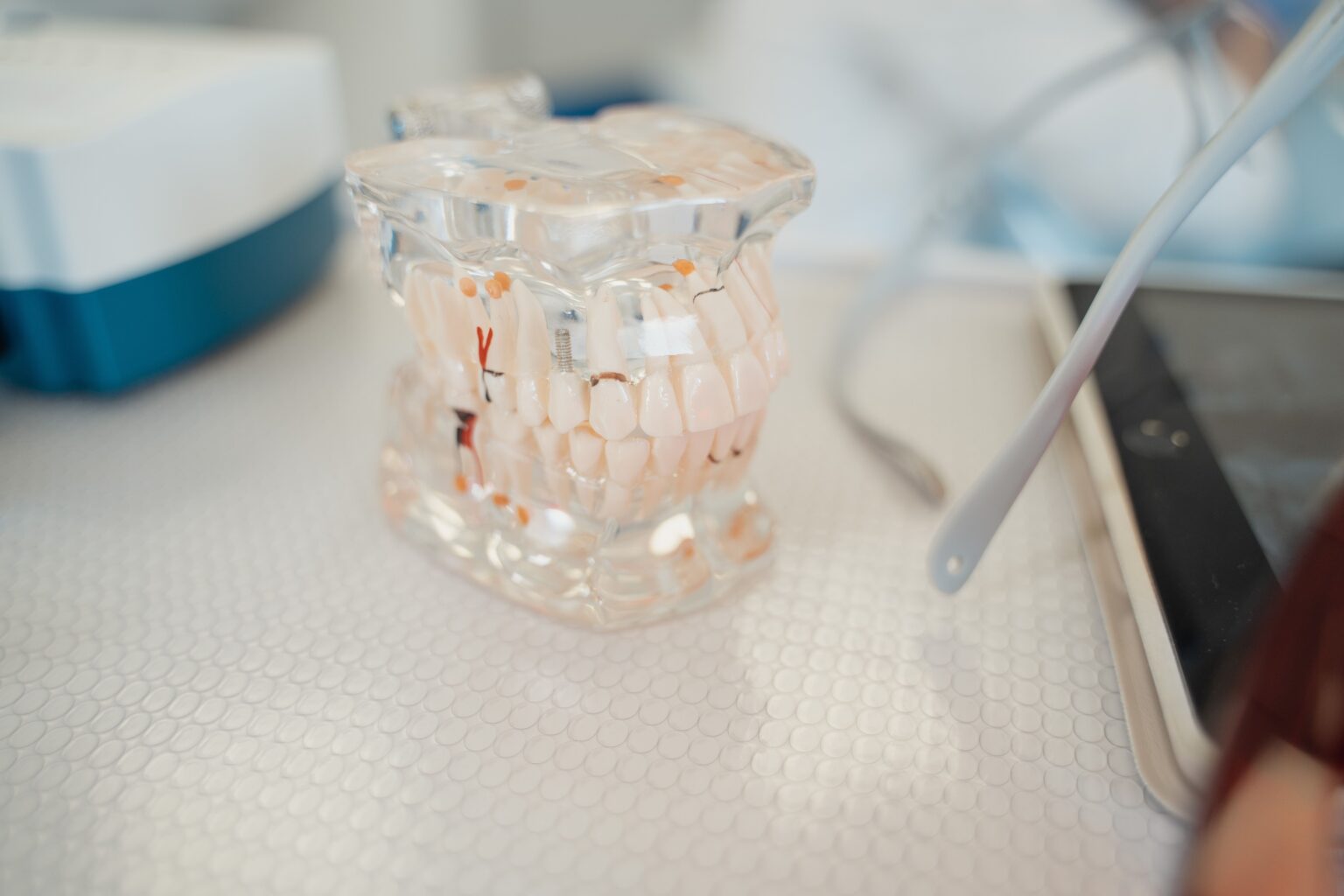 Are You a Candidate for Full-Arch Dental Implants? Key Factors to Consider